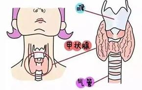 图片加载失败